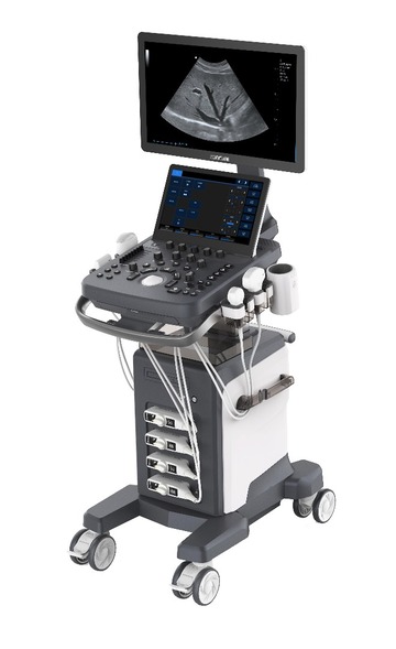 Advancing Diagnostic Accuracy With Modern Ultrasound Technology