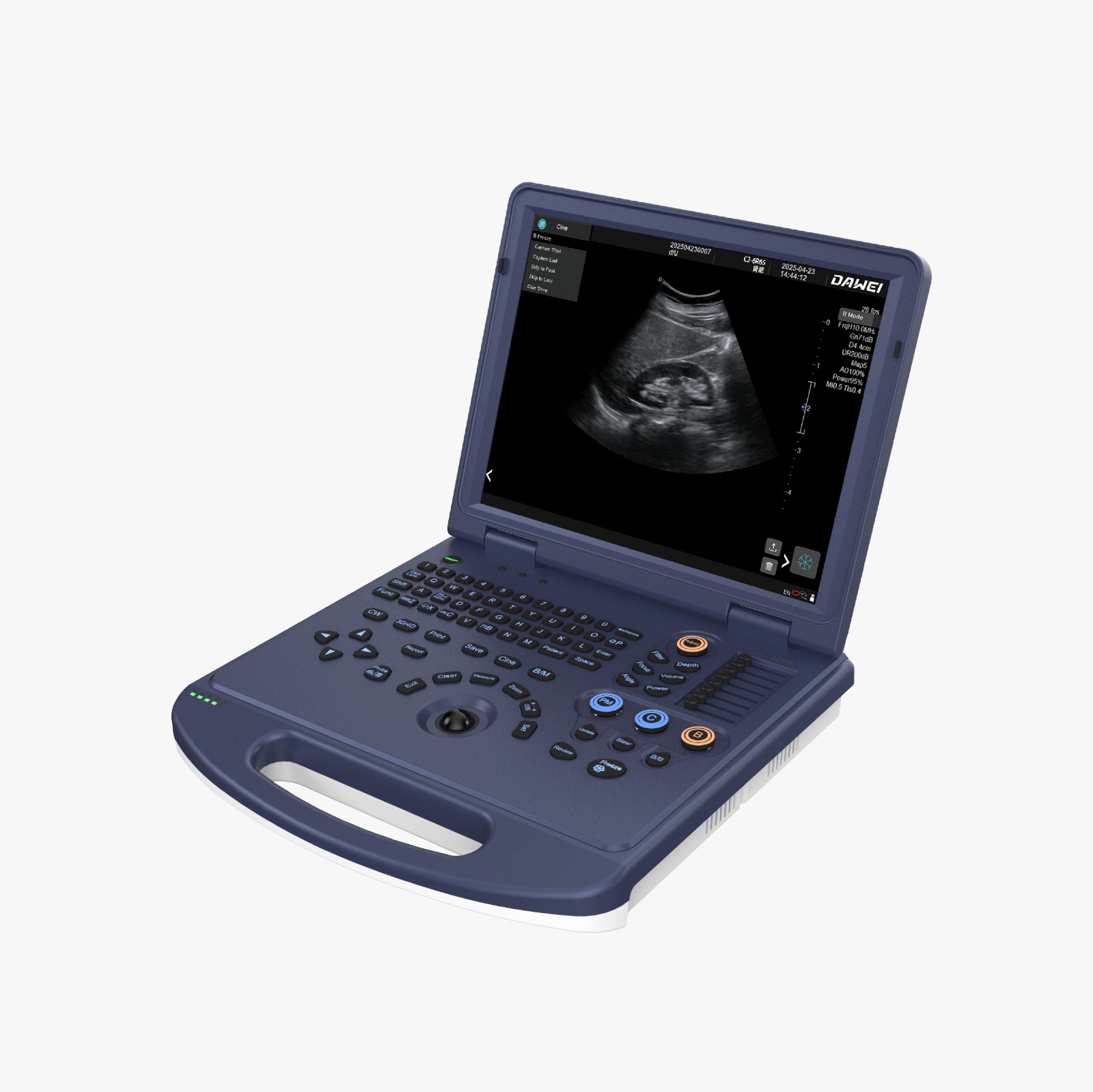 DW L3i Colour Doppler with Convex and Linear or T/V Probe