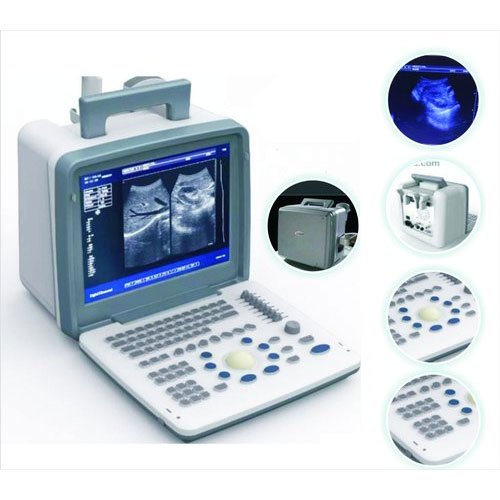 XF-300 B/W Unit with Convex Probe