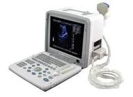 XF-300 B/W Unit with Convex Probe