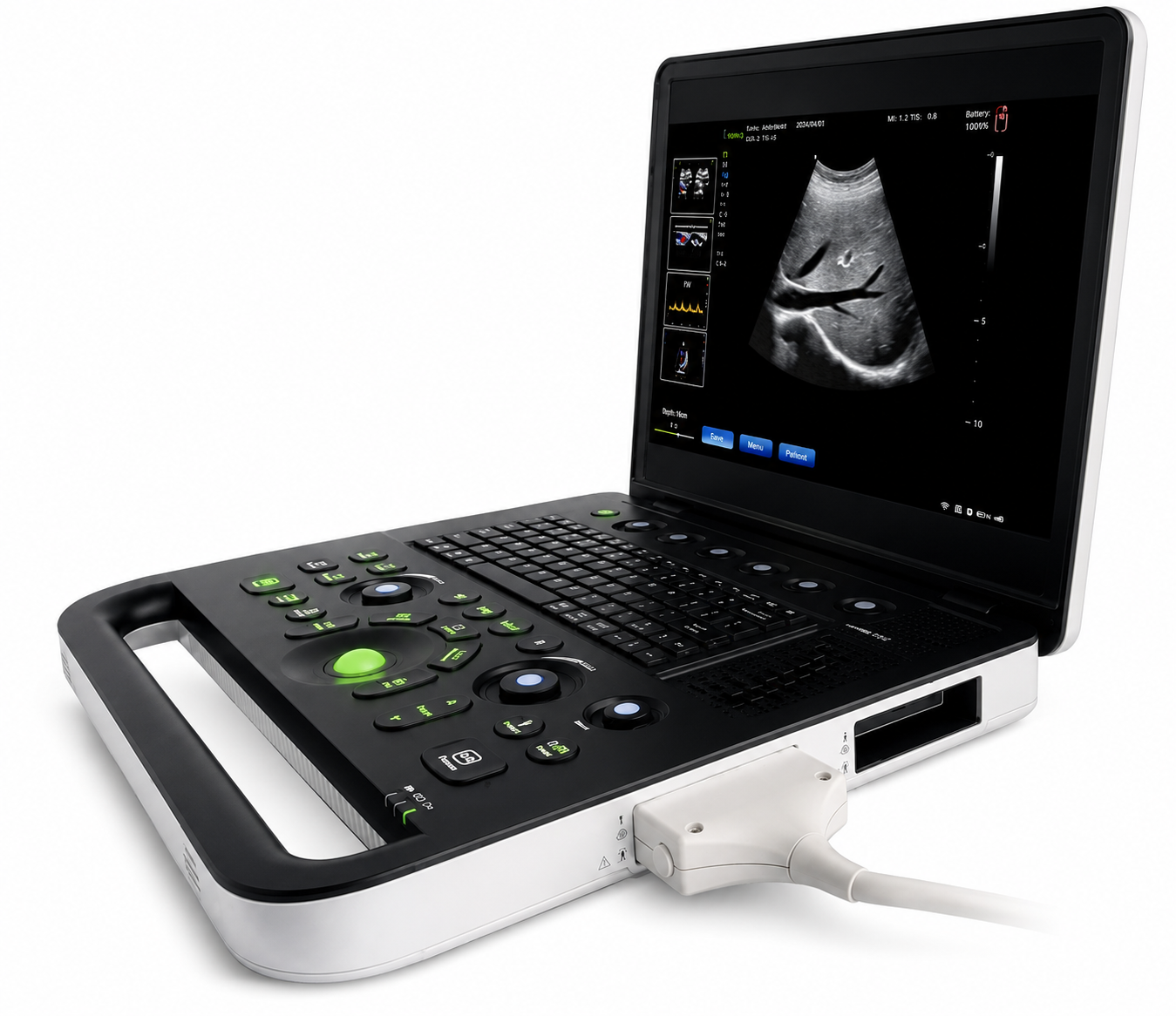 VET-SN50 Vet Ultrasound (with Convex Probe)
