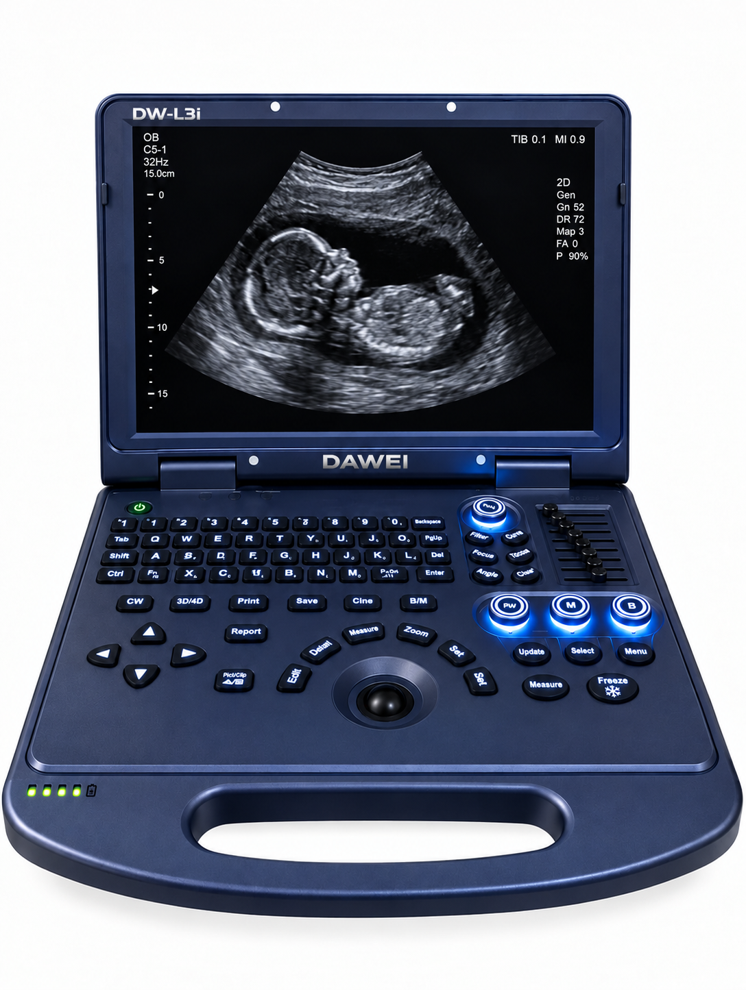 DW L3i Colour-Doppler Portable Ultrasound